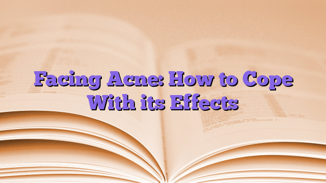 Facing Acne: How to Cope With its Effects