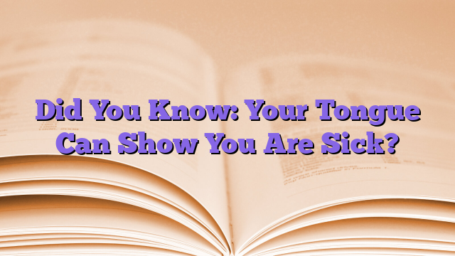 Did You Know: Your Tongue Can Show You Are Sick?